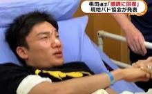 バドミントン桃田賢斗選手、もう回復